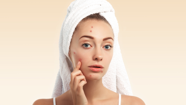 Break Up with Breakouts: The Best Sheets for Acne-Prone Skin