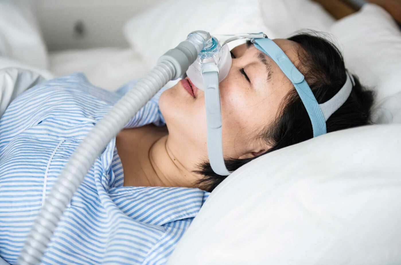 CPAP vs eXciteOSA