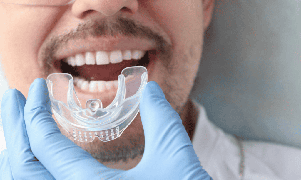 Mandibular Advancement Device